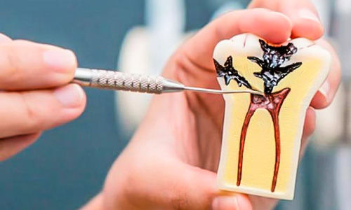 Endodontist