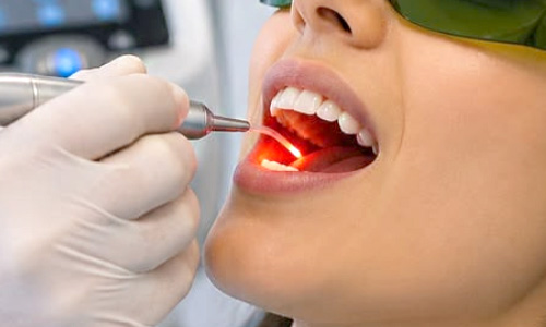 Laser Dentistry