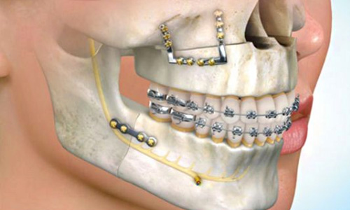 Oral and Maxillofacial Surgery