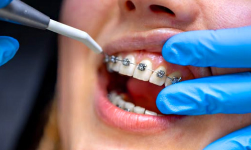 Orthodontist