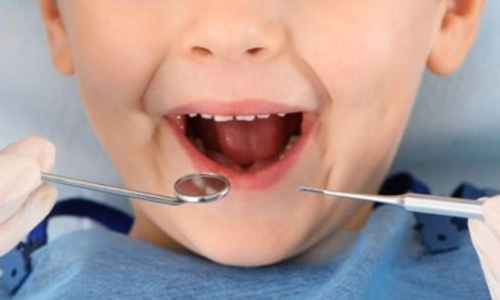 Paediatric Dentistry
